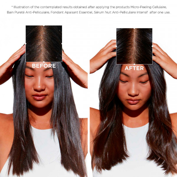 symbiose-bain-purete-anti-pelliculaire-shampoing-antipelliculaire