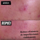 gently-effective-blemish-targeting-akne-reinigungsbehandlung