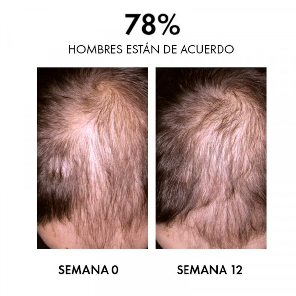 dercos-aminexil-clinical-regen-booster-hair-serum