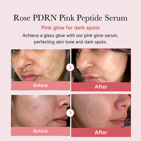 pdrn-pink-peptide-serum-serum-hydratant-et-raffermissant