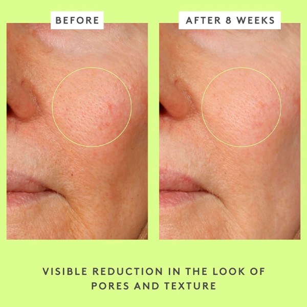 tlc-framboos-glycolic-night-serum-nattserum