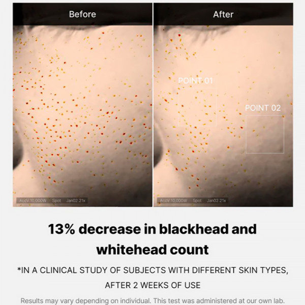 zero-pore-one-day-serum-peelingujace-serum-do-twarzy-srodek-oczyszczajacy