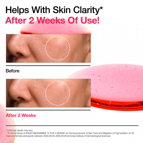 niacinamide-10-txa-4-serum-serum-intensivo-anti-manchas-escuras-e-iluminador