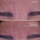renergie-collagen-lift-xtend-creme-facial-com-colageno