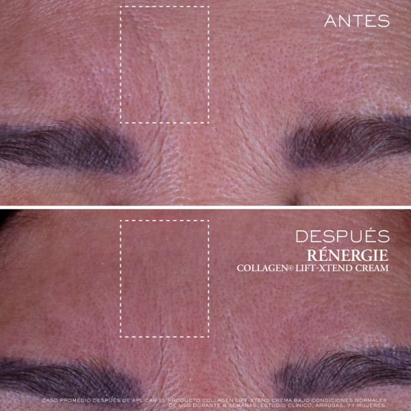 renergie-collagen-lift-xtend-ansigtscreme-med-kollagen