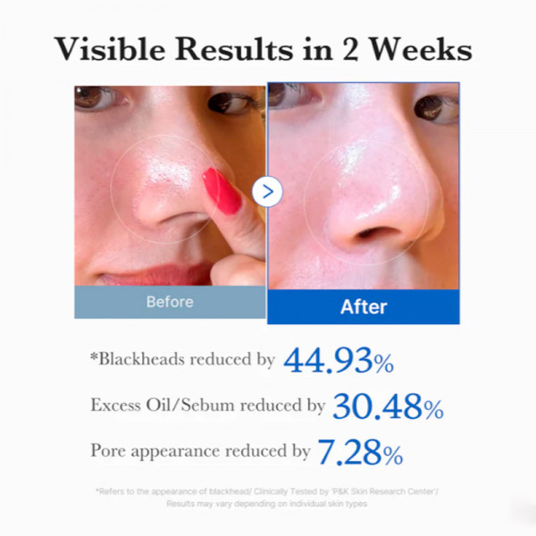 zero-pore-pads-disques-exfoliants