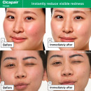 cicapair-redness-rescue-set