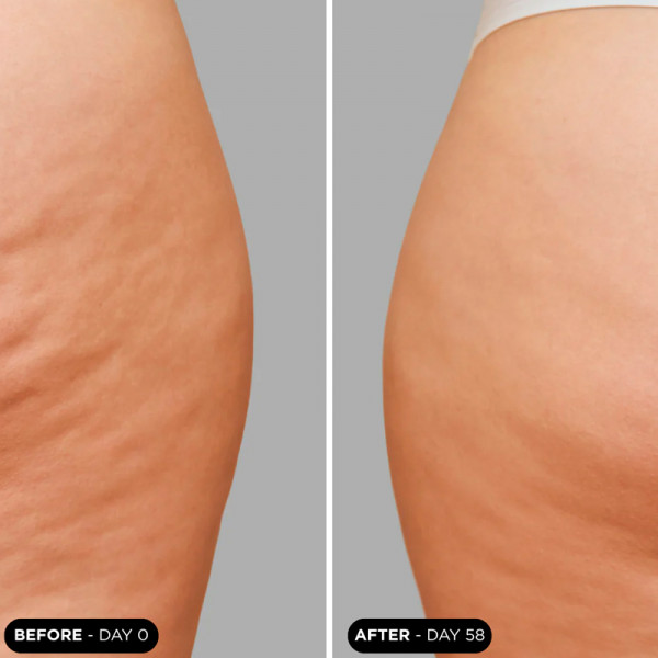 unicbody-slim-action-x4-toning-body-treatment