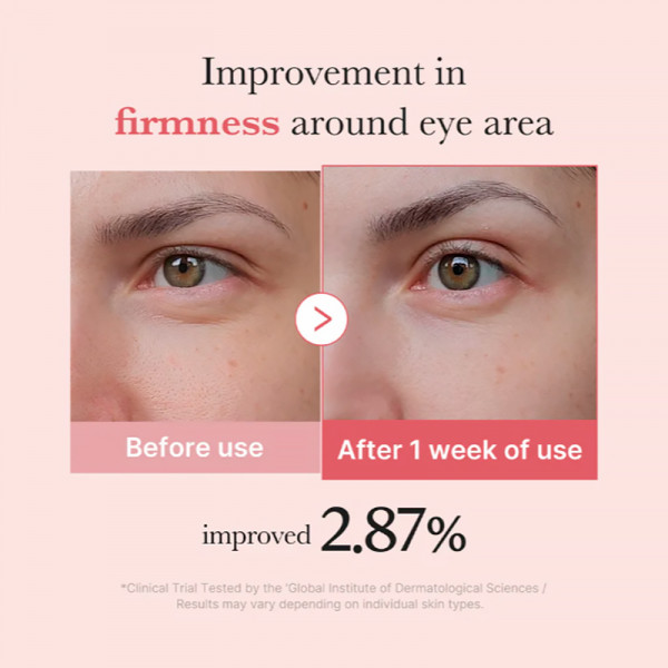 pdrn-pink-peptide-eye-cream-crema-regeneradora-contorno-de-ojo