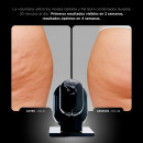 unitech-body-slim-dispositivo-corporal-de-silhueta-perfeita