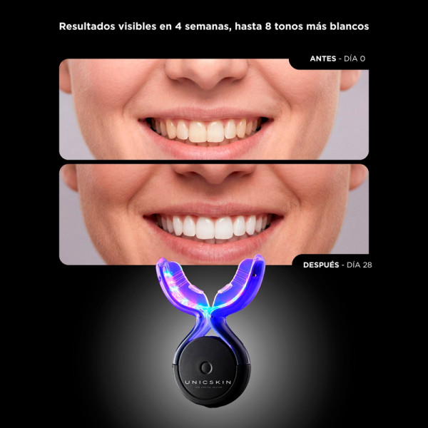 unicled-white-smile-50-tecnologia-de-clareamento-dental