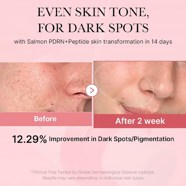 pdrn-pink-peptide-toner-lotion-tonique-apaisante-cica-a-la-pyridoxine-pour-un-teint-irregulier-et-un-effet-apaisant