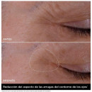 double-serum-eye-anti-aging-eye-contour-serum