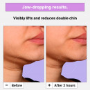 cryo-v-jawline-lifting-mask-lifting-effekt-maske