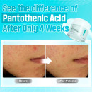 no1-pantothenic-b5-active-soothing-cream-creme-visage-apaisante-et-seboregulatrice