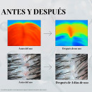 pdrn-reedle-shot-hair-ampoule-100dl-ampoule-capillaire-fortifiante-et-revitalisante