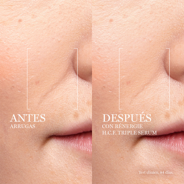 Rénergie H.C.F. Triple Serum
