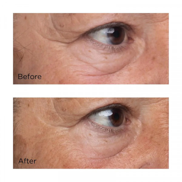 high-potency-growth-factor-firming-lifting-eye-serum