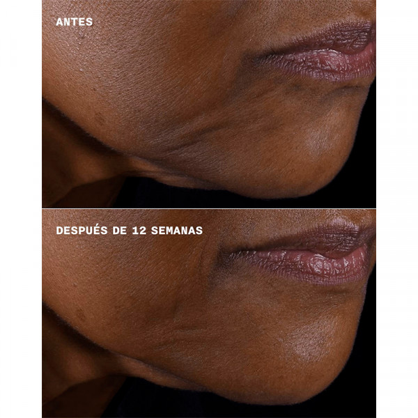 Crema hidratante Smart Clinical Repair Firmeza + Lifting para Rostro y Cuello
