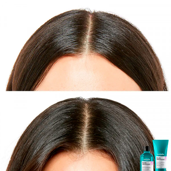 scalp-advanced-champu-anti-malestar