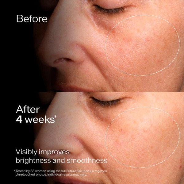 future-solution-lx-concentrated-brightening-softener-ausgleichende-lotion-feuchtigkeitsspendend
