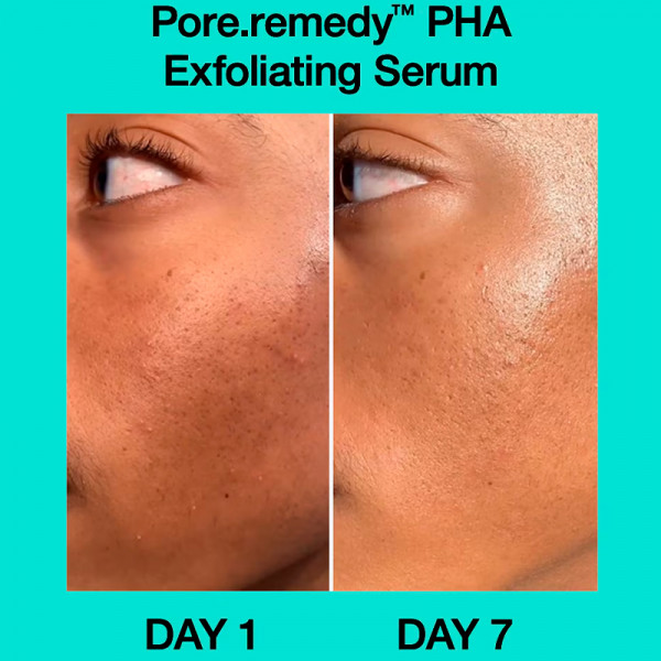 pore-remedy-pha-exfoliating-serum-serum-exfoliante-pha
