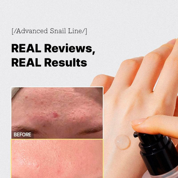 geavanceerde-slak-96-mucine-power-essence-regeneratieve-behandeling-anti-rimpel