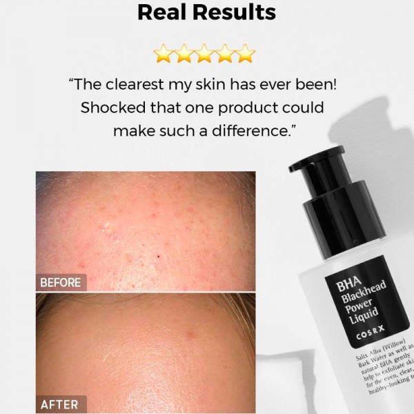 bha-blackhead-power-liquid-trattamento-per-punti-neri-e-imperfezioni