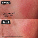 ultra-facial-advanced-repair-barrier-cream