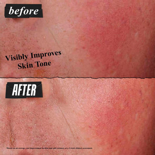 ultra-facial-advanced-repair-barrier-cream