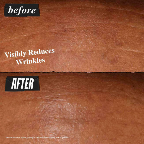 retinol-fast-release-wrinkle-reducing-night-serum