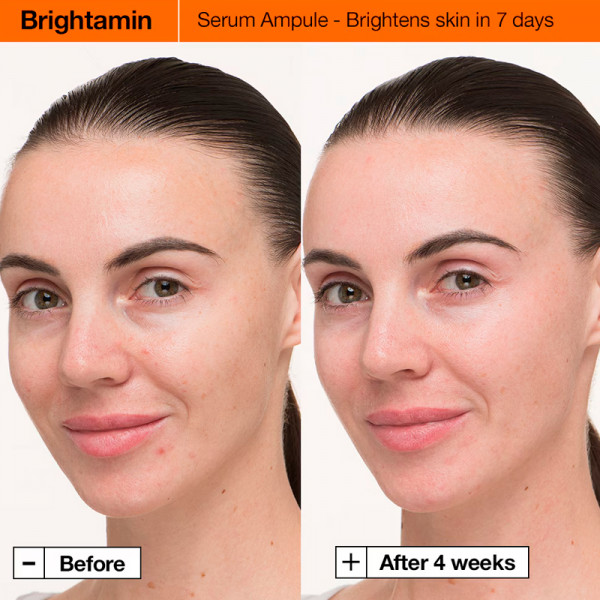 brightamin-brightening-serum-siero-con-niacinamide-e-vitamina-c